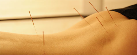 bild1